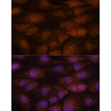 Immunofluorescence - Anti-CCDC21 Antibody (A87776) - Antibodies.com
