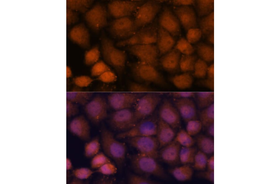 Immunofluorescence - Anti-CCDC21 Antibody (A87776) - Antibodies.com