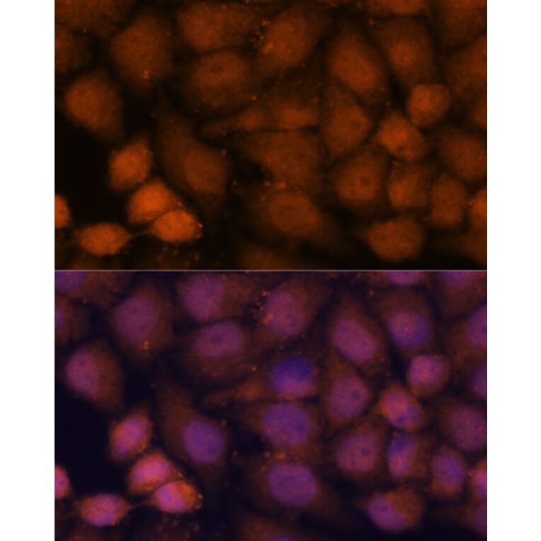 Immunofluorescence - Anti-CCDC21 Antibody (A87776) - Antibodies.com