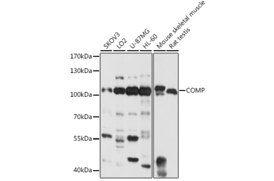 Western Blot - Anti-COMP/Cartilage oligomeric matrix protein Antibody (A87777) - Antibodies.com