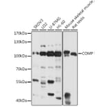Western Blot - Anti-COMP/Cartilage oligomeric matrix protein Antibody (A87777) - Antibodies.com