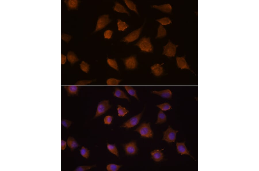 Immunofluorescence - Anti-COMP/Cartilage oligomeric matrix protein Antibody (A87777) - Antibodies.com
