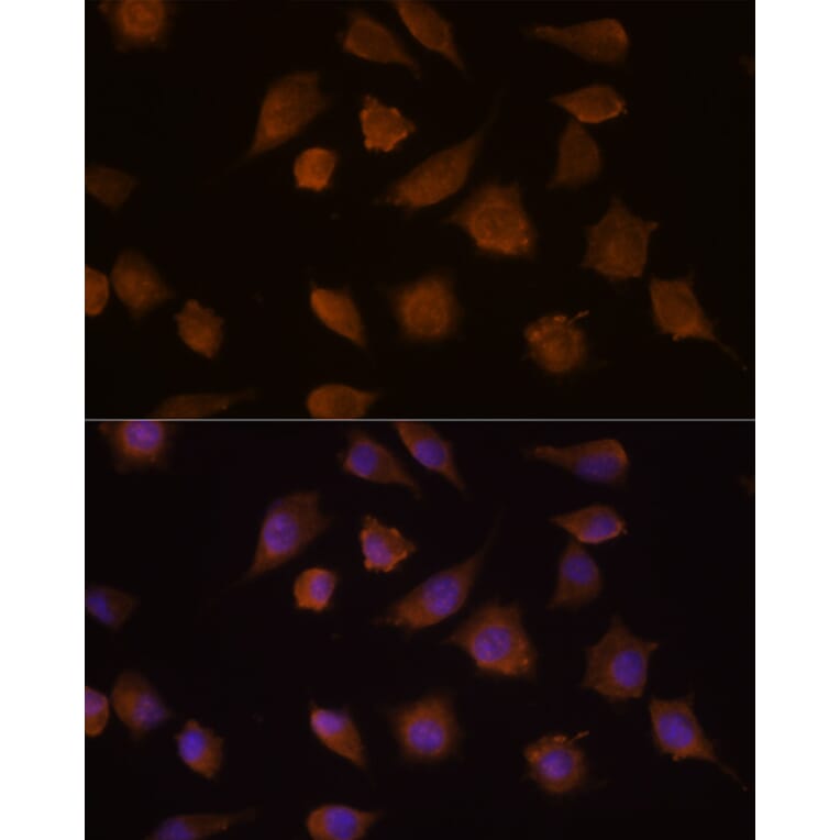 Immunofluorescence - Anti-COMP/Cartilage oligomeric matrix protein Antibody (A87777) - Antibodies.com