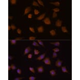 Immunofluorescence - Anti-COMP/Cartilage oligomeric matrix protein Antibody (A87777) - Antibodies.com