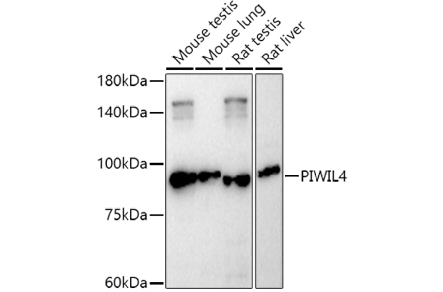 Western Blot - Anti-PIWIL4/PIWI Antibody (A87778) - Antibodies.com
