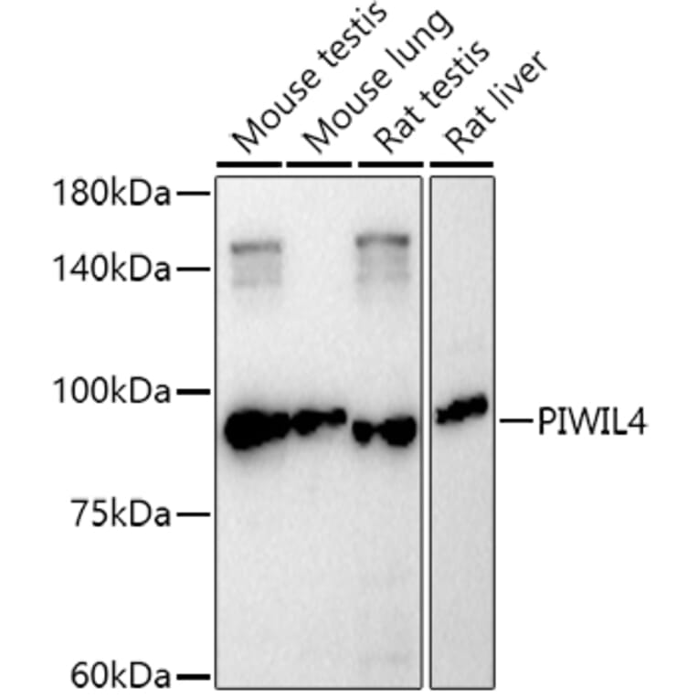 Western Blot - Anti-PIWIL4/PIWI Antibody (A87778) - Antibodies.com