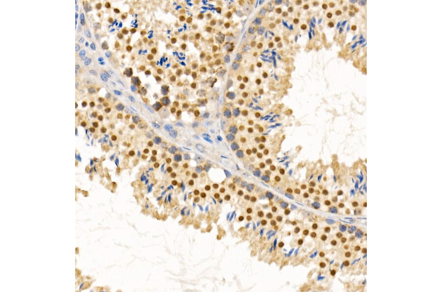 Immunohistochemistry - Anti-PIWIL4/PIWI Antibody (A87778) - Antibodies.com