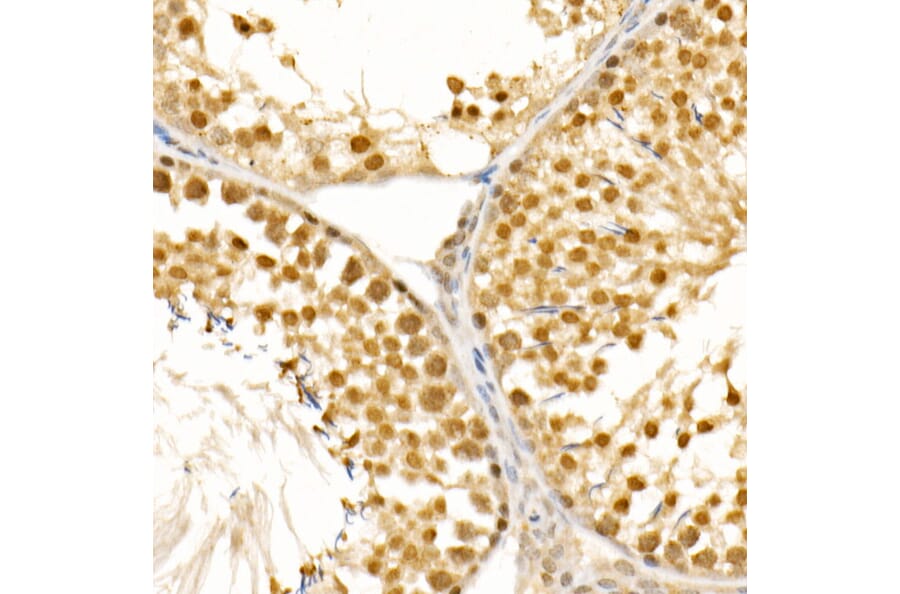 Immunohistochemistry - Anti-PIWIL4/PIWI Antibody (A87778) - Antibodies.com