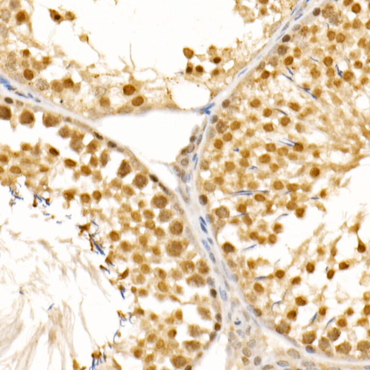 Immunohistochemistry - Anti-PIWIL4/PIWI Antibody (A87778) - Antibodies.com