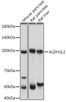 Western blot analysis of extracts of various cell lines, using Anti-ALDH1L2 Antibody (A14455) at 1:1,000 dilution.
Secondary antibody: Goat Anti-Rabbit IgG (H+L) (HRP) (AS014) at 1:10,000 dilution.
Lysates / proteins: 25µg per lane.
Blocking buffer: 3% non-fat dry milk in TBST.
Detection: ECL Basic Kit (RM00020).
Exposure time: 1s.
