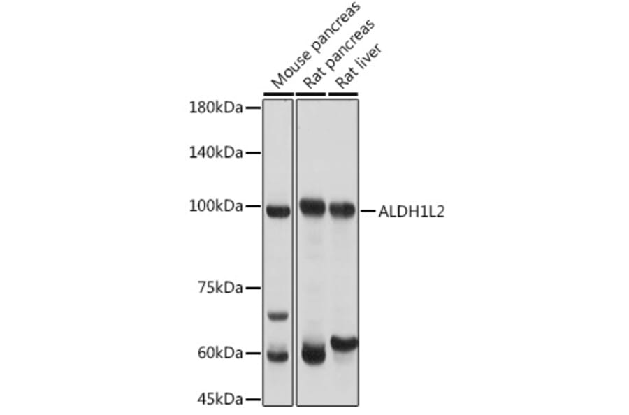 Western Blot - Anti-ALDH1L2 Antibody (A87779) - Antibodies.com