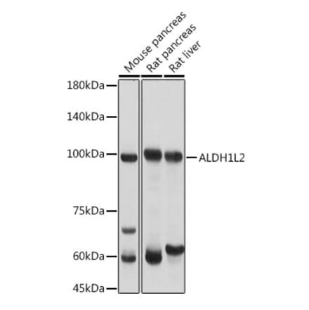 Western Blot - Anti-ALDH1L2 Antibody (A87779) - Antibodies.com