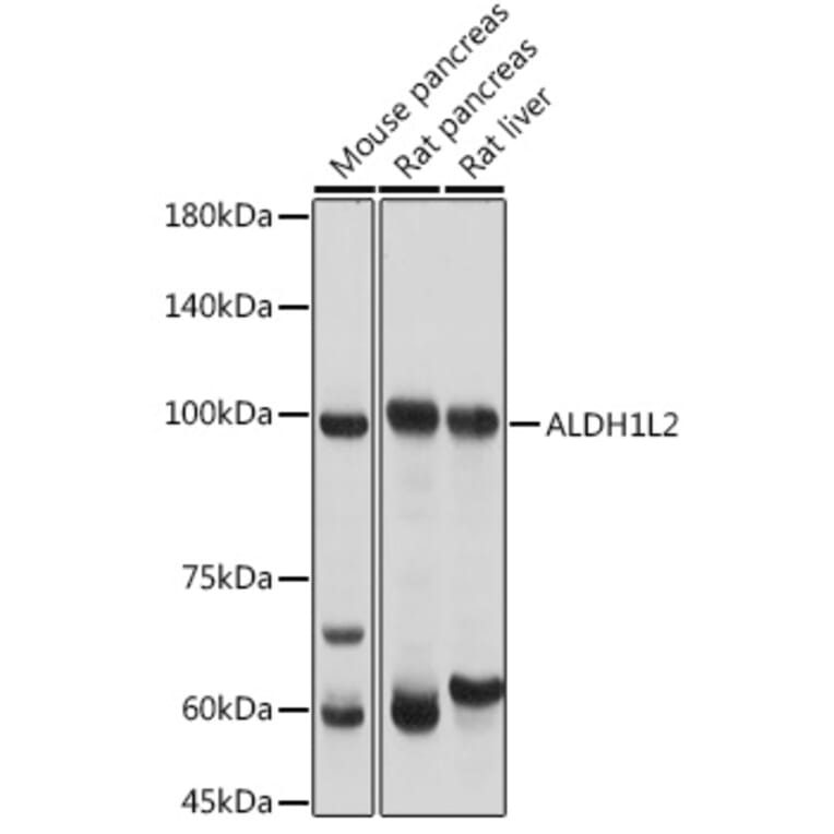 Western Blot - Anti-ALDH1L2 Antibody (A87779) - Antibodies.com