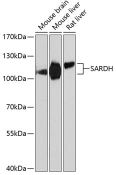 Western blot analysis of extracts of various cell lines, using Anti-SARDH Antibody (A9541) at 1:3000 dilution.
Secondary antibody: Goat Anti-Rabbit IgG (H+L) (HRP) (AS014) at 1:10,000 dilution.
Lysates / proteins: 25µg per lane.
Blocking buffer: 3% non-fat dry milk in TBST.
Detection: ECL Basic Kit (RM00020).
Exposure time: 90s.