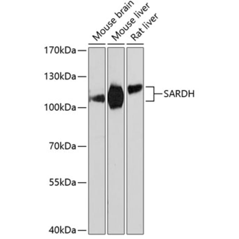 Western Blot - Anti-SARDH Antibody (A87780) - Antibodies.com