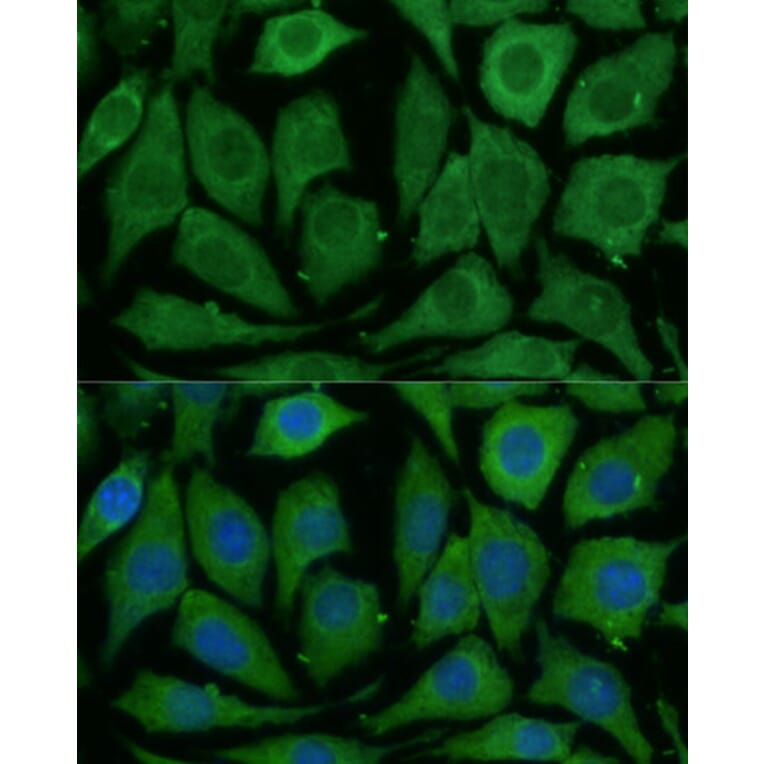 Immunofluorescence - Anti-SARDH Antibody (A87780) - Antibodies.com