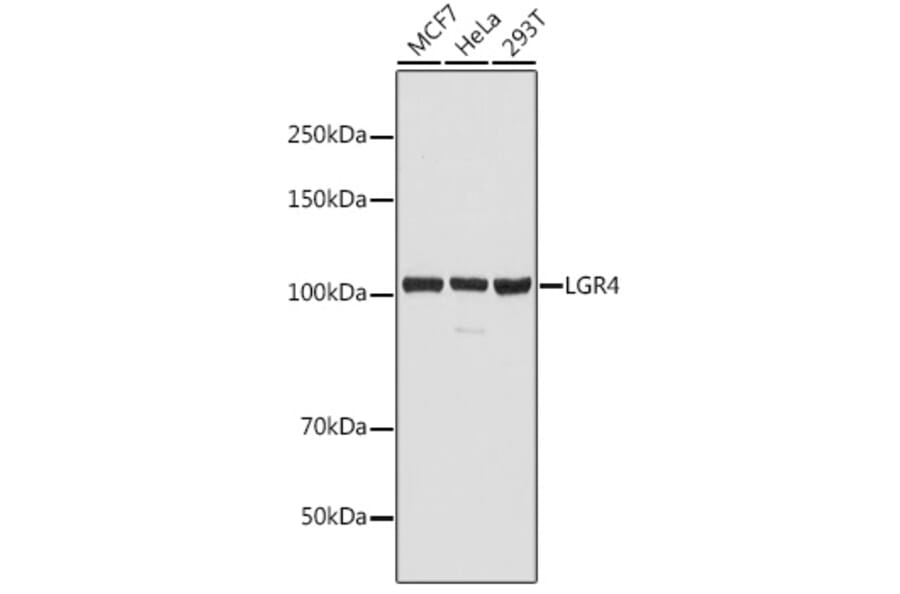 Western Blot - Anti-GPCR GPR48/LGR4 Antibody (A87781) - Antibodies.com