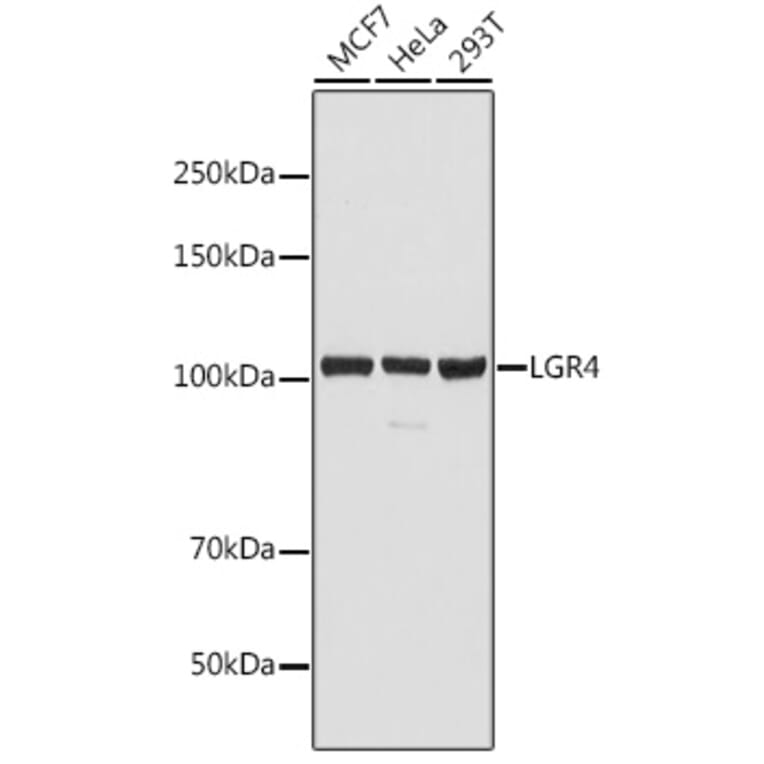 Western Blot - Anti-GPCR GPR48/LGR4 Antibody (A87781) - Antibodies.com