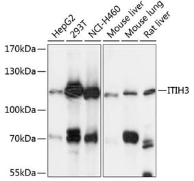 Western Blot - Anti-ITIH3 Antibody (A87782) - Antibodies.com