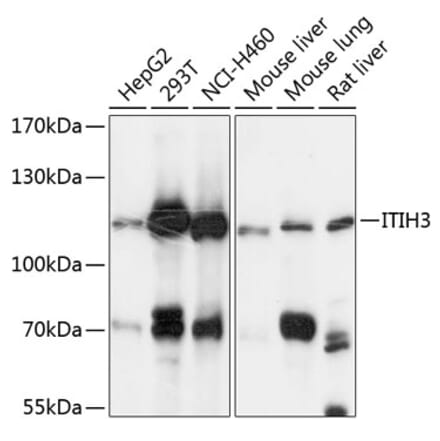 Western Blot - Anti-ITIH3 Antibody (A87782) - Antibodies.com