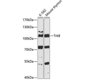 Western Blot - Anti-TrkB Antibody (A87783) - Antibodies.com