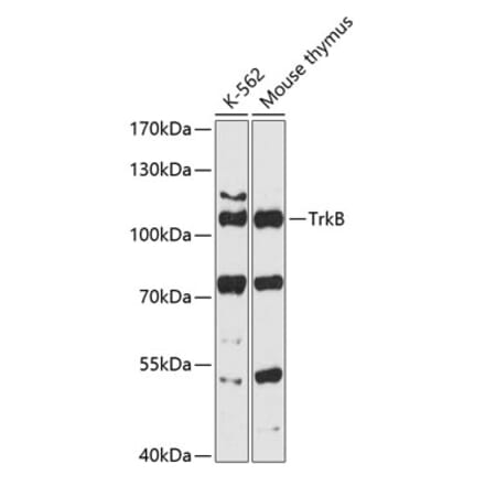 Western Blot - Anti-TrkB Antibody (A87783) - Antibodies.com