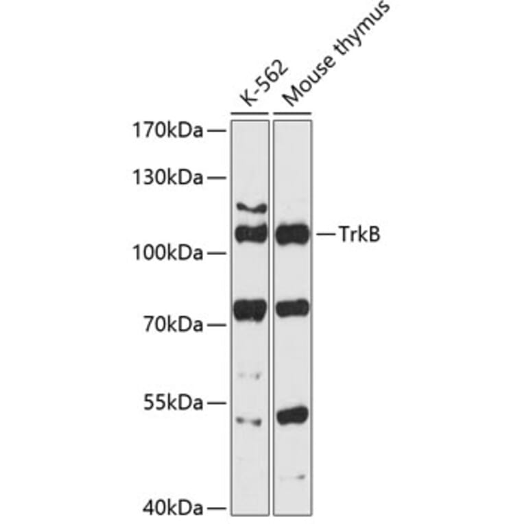 Western Blot - Anti-TrkB Antibody (A87783) - Antibodies.com