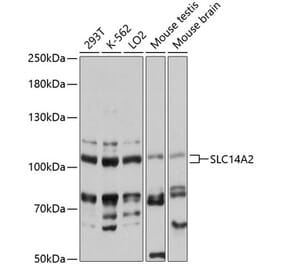 Western Blot - Anti-SLC14A2 Antibody (A87784) - Antibodies.com
