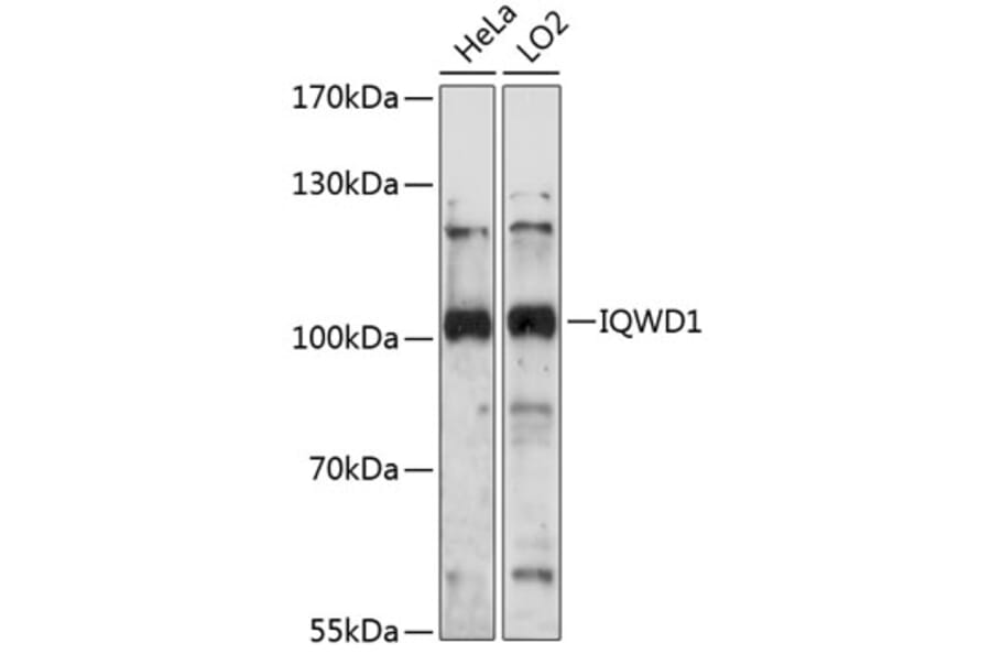 Western Blot - Anti-NRIP Antibody (A87785) - Antibodies.com