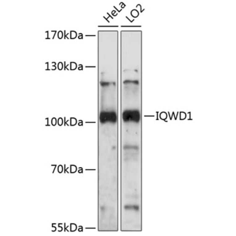 Western Blot - Anti-NRIP Antibody (A87785) - Antibodies.com