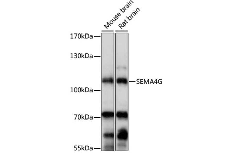 Western Blot - Anti-SEMA4G Antibody (A87786) - Antibodies.com