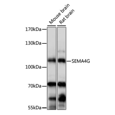Western Blot - Anti-SEMA4G Antibody (A87786) - Antibodies.com