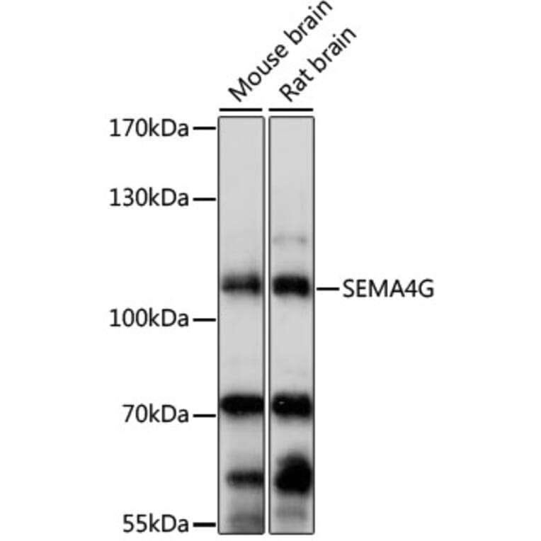 Western Blot - Anti-SEMA4G Antibody (A87786) - Antibodies.com