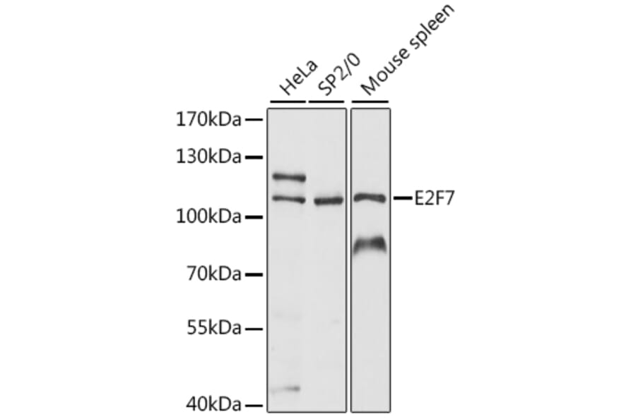 Western Blot - Anti-E2F7 Antibody (A87787) - Antibodies.com