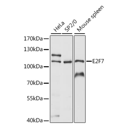 Western Blot - Anti-E2F7 Antibody (A87787) - Antibodies.com
