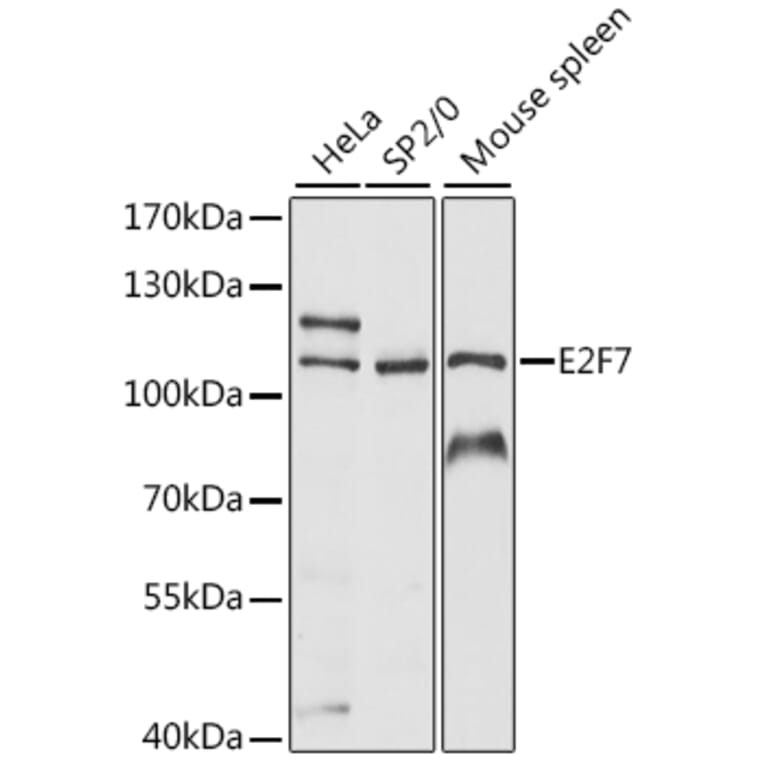 Western Blot - Anti-E2F7 Antibody (A87787) - Antibodies.com