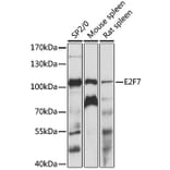 Western Blot - Anti-E2F7 Antibody (A87787) - Antibodies.com