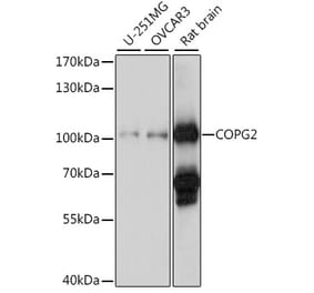 Western Blot - Anti-COPG2 Antibody (A87788) - Antibodies.com