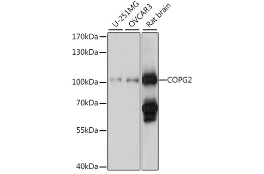 Western Blot - Anti-COPG2 Antibody (A87788) - Antibodies.com