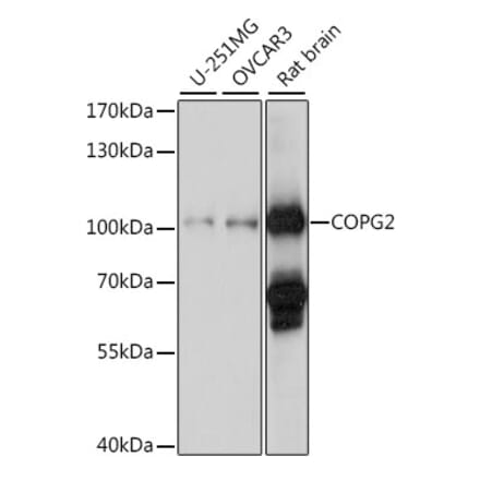 Western Blot - Anti-COPG2 Antibody (A87788) - Antibodies.com