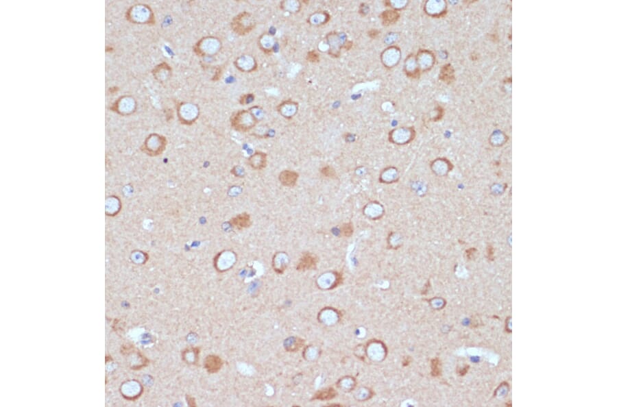Immunohistochemistry - Anti-COPG2 Antibody (A87788) - Antibodies.com