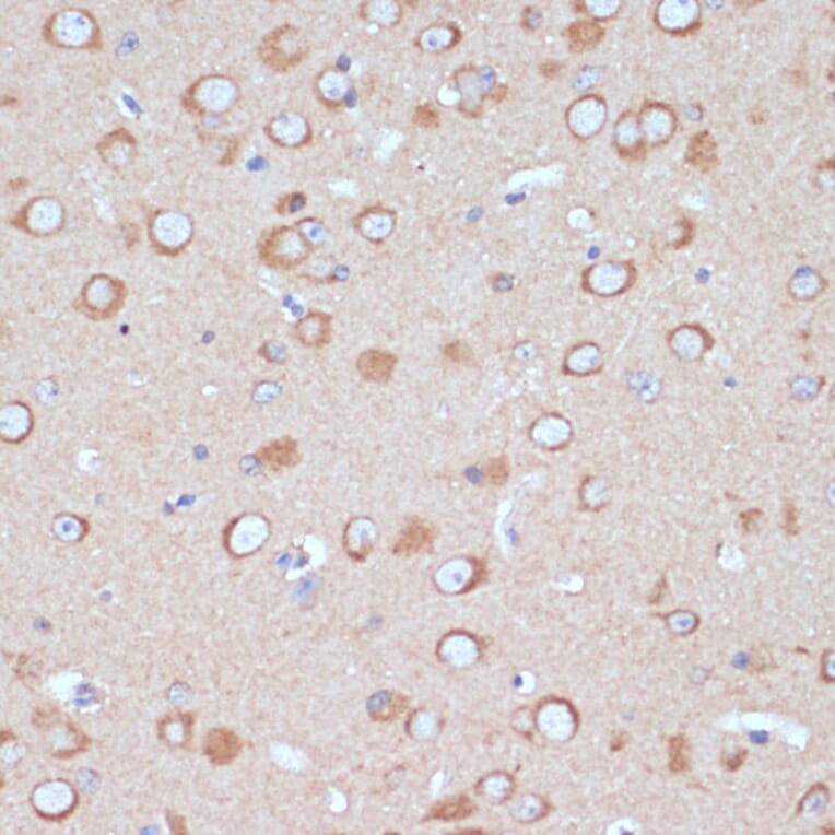 Immunohistochemistry - Anti-COPG2 Antibody (A87788) - Antibodies.com