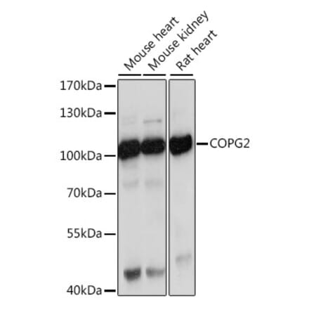 Western Blot - Anti-COPG2 Antibody (A87789) - Antibodies.com