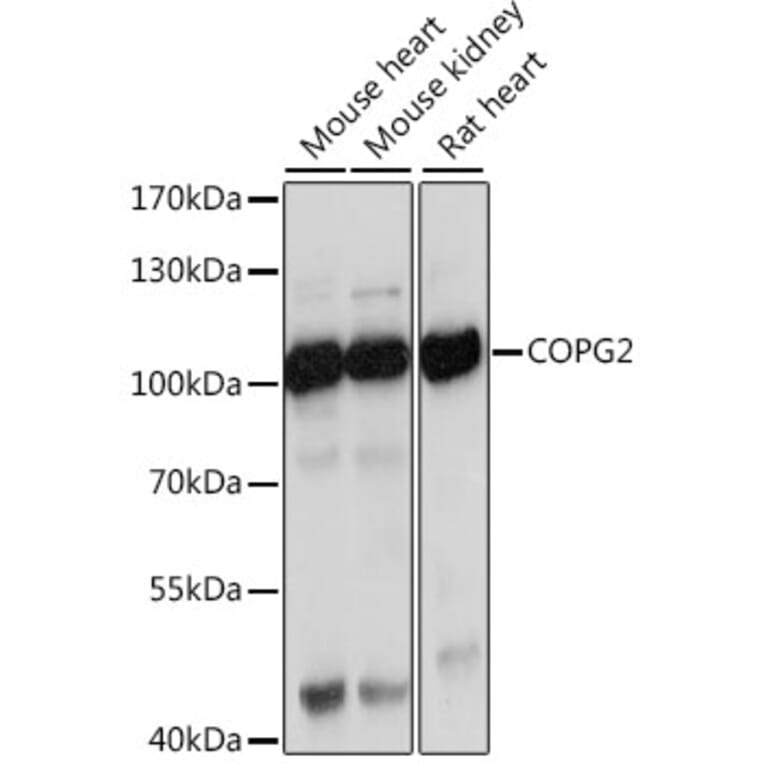 Western Blot - Anti-COPG2 Antibody (A87789) - Antibodies.com