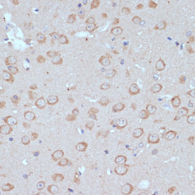 Immunohistochemistry - Anti-COPG2 Antibody (A87789) - Antibodies.com