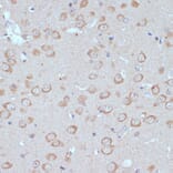 Immunohistochemistry - Anti-COPG2 Antibody (A87789) - Antibodies.com