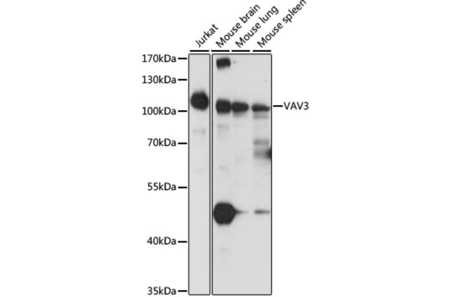 Western Blot - Anti-VAV3 Antibody (A87790) - Antibodies.com