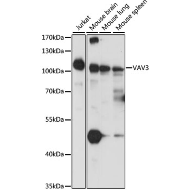 Western Blot - Anti-VAV3 Antibody (A87790) - Antibodies.com