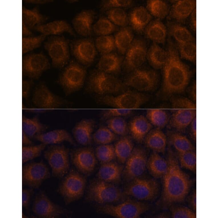 Immunofluorescence - Anti-VAV3 Antibody (A87790) - Antibodies.com