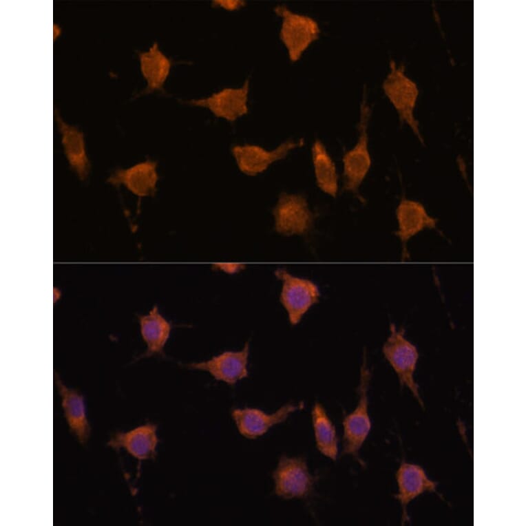 Immunofluorescence - Anti-VAV3 Antibody (A87790) - Antibodies.com